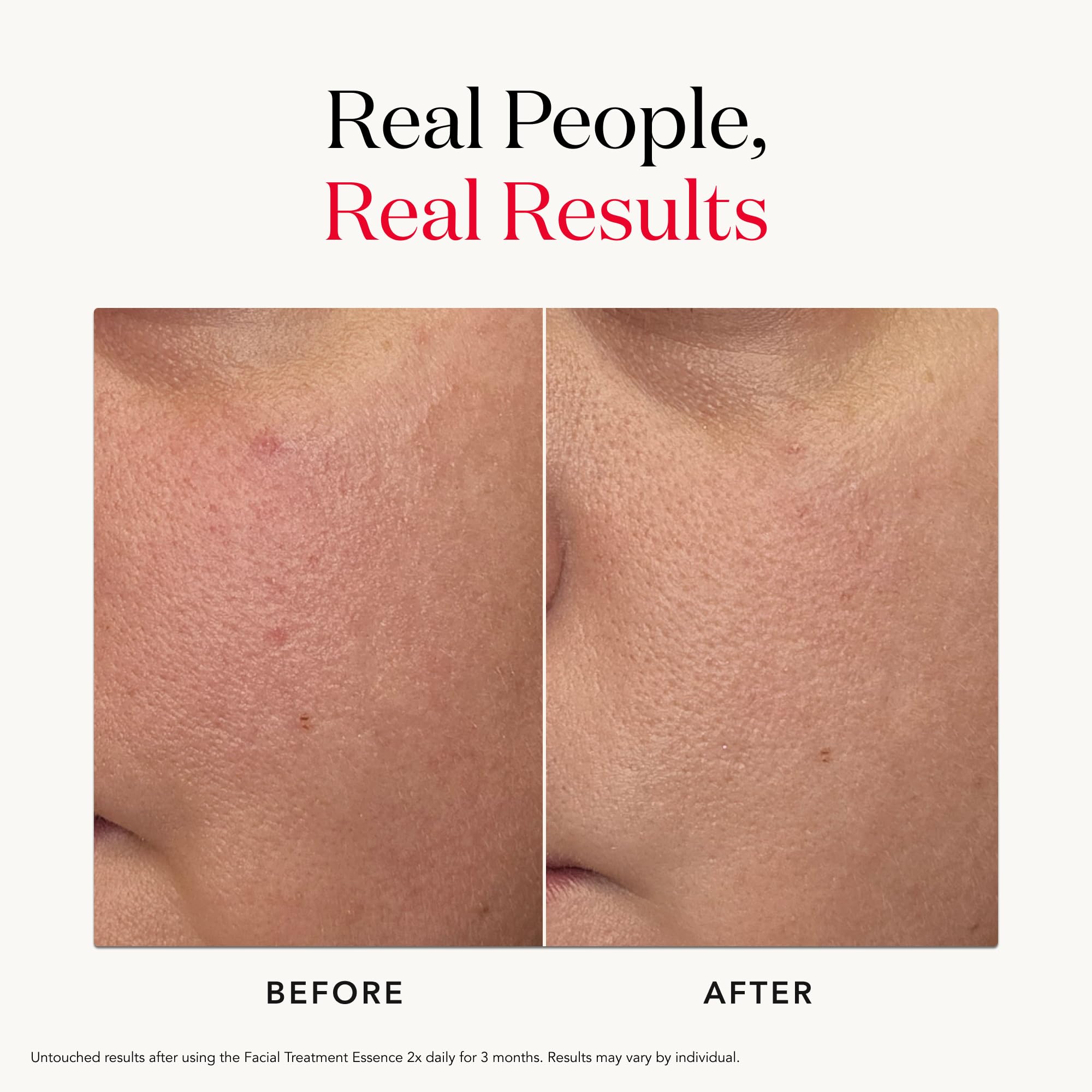SK-II Facial Treatment Essence - Anti-Aging Essence Skincare to Help Reduce the Appearance of Fine Lines & Wrinkles - Visibly Refines Texture & Improves Firmness & Dark Spots