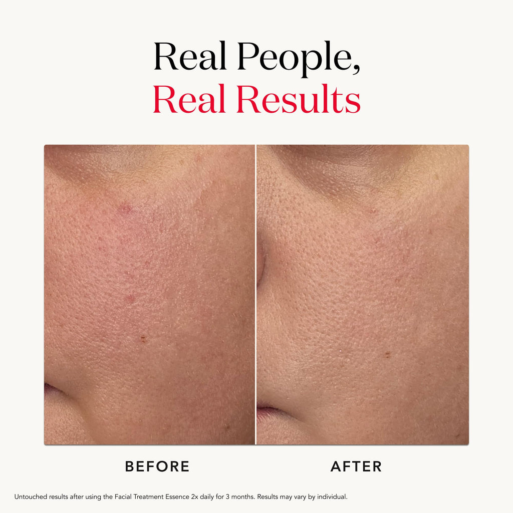SK-II Facial Treatment Essence - Anti-Aging Essence Skincare to Help Reduce the Appearance of Fine Lines & Wrinkles - Visibly Refines Texture & Improves Firmness & Dark Spots