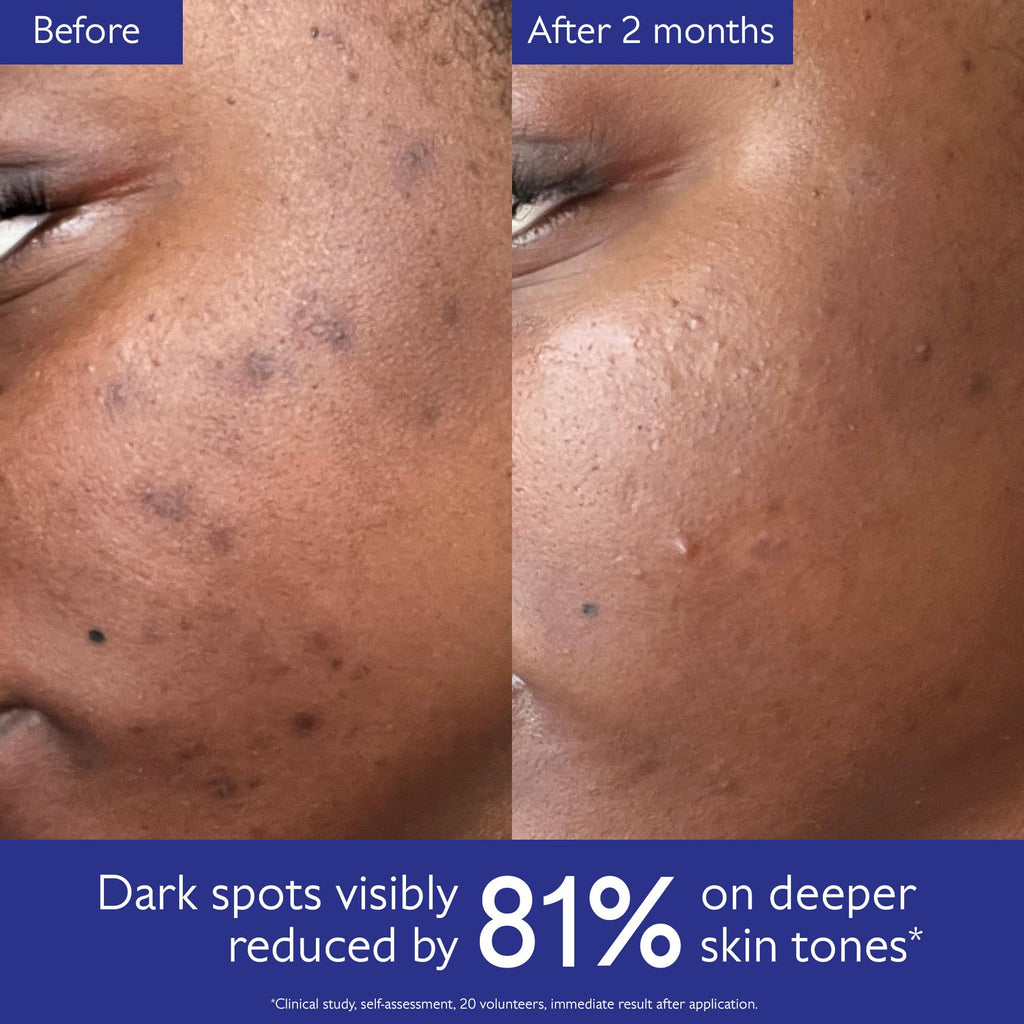 Caudalie Vinoperfect Brightening Dark Spot Serum Vitamin C Alternative - 62x More Effective than Vitamin C with Viniferine for a Visibly Brighter Even Complexion
