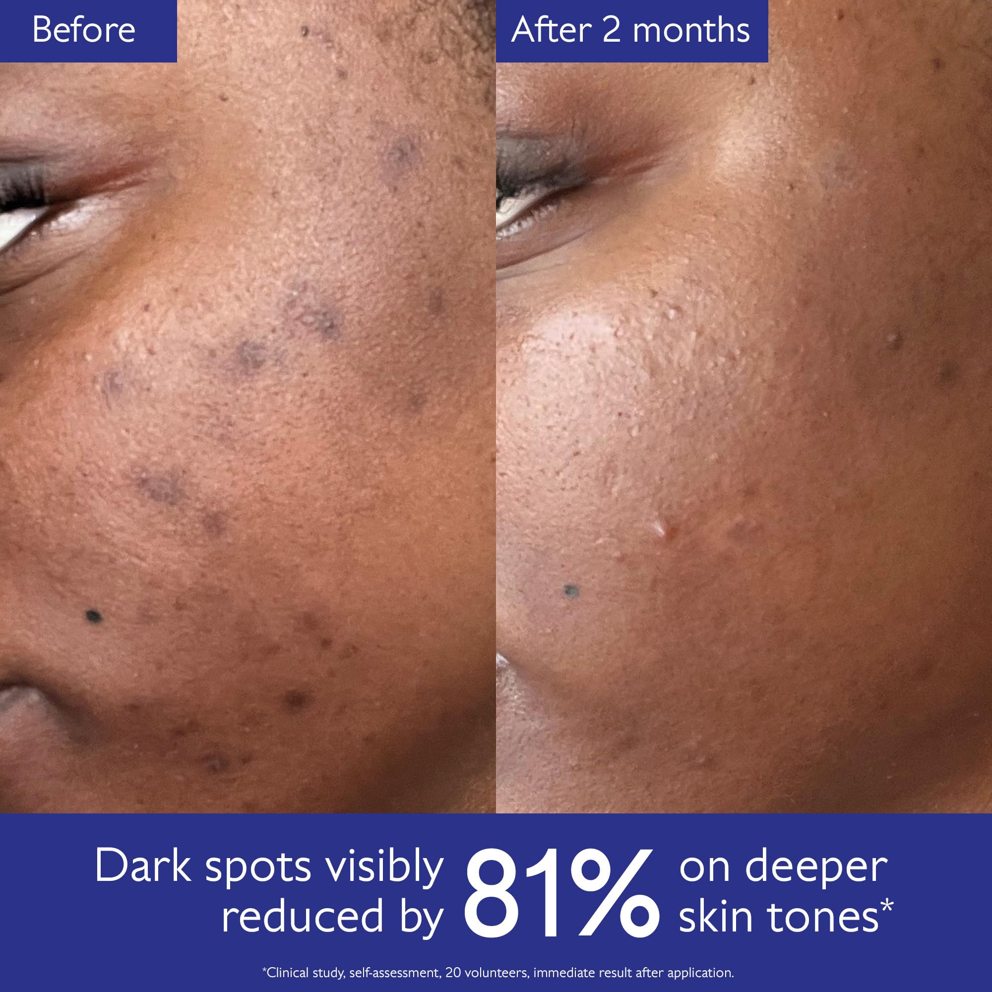 Caudalie Vinoperfect Brightening Dark Spot Serum Vitamin C Alternative - 62x More Effective than Vitamin C with Viniferine for a Visibly Brighter Even Complexion